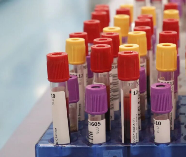 Seconda vittima per intossicazione da botulino in Sardegna, è una 62enne del Cagliaritano