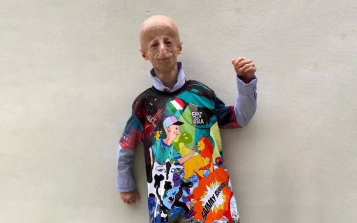 Sammy Basso